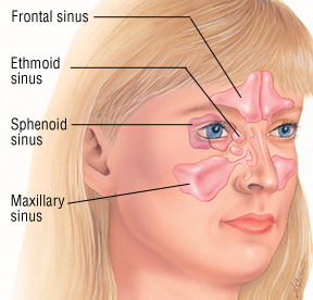 Acute Sinusitis Ayurvedic Treatment in Townsville